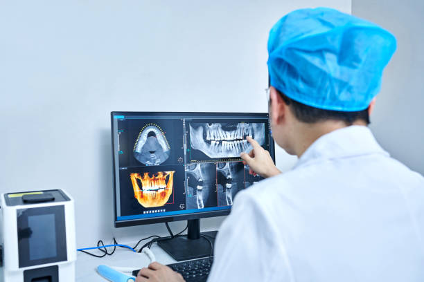 Best Emergency Wisdom Teeth Removal in Hartford, IL